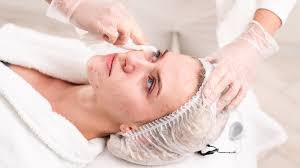 Treatments For Acne